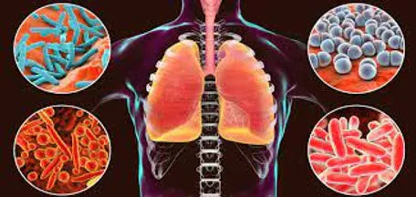 Consultant  Respiratory Medicine